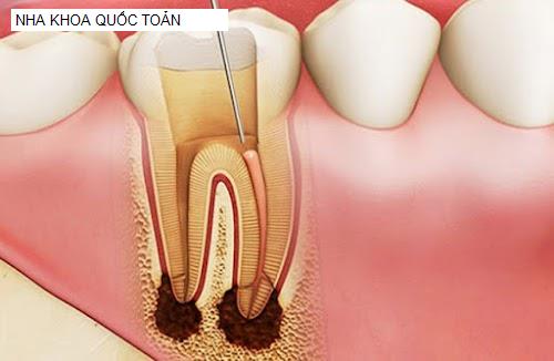 Hình ảnh NHA KHOA QUỐC TOẢN