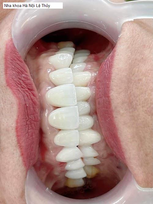 Hình ảnh Nha khoa Hà Nội Lệ Thủy